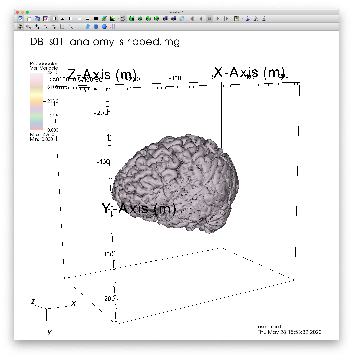 ../_images/MRI_Pink_Brain.png