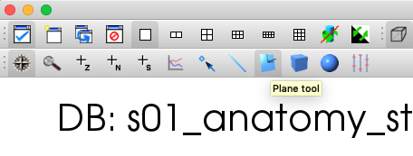 ../_images/MRI_Plane_Tool_Button.png