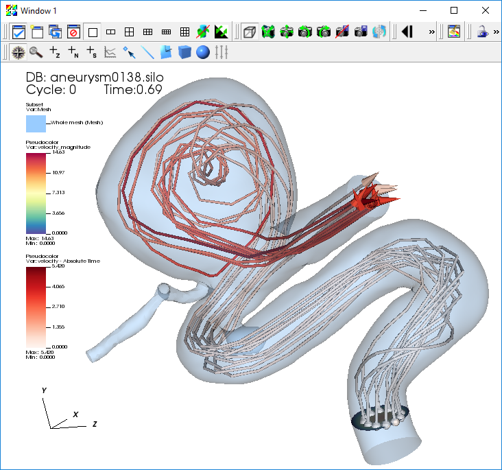 ../_images/Aneurysm-Streamlines.png