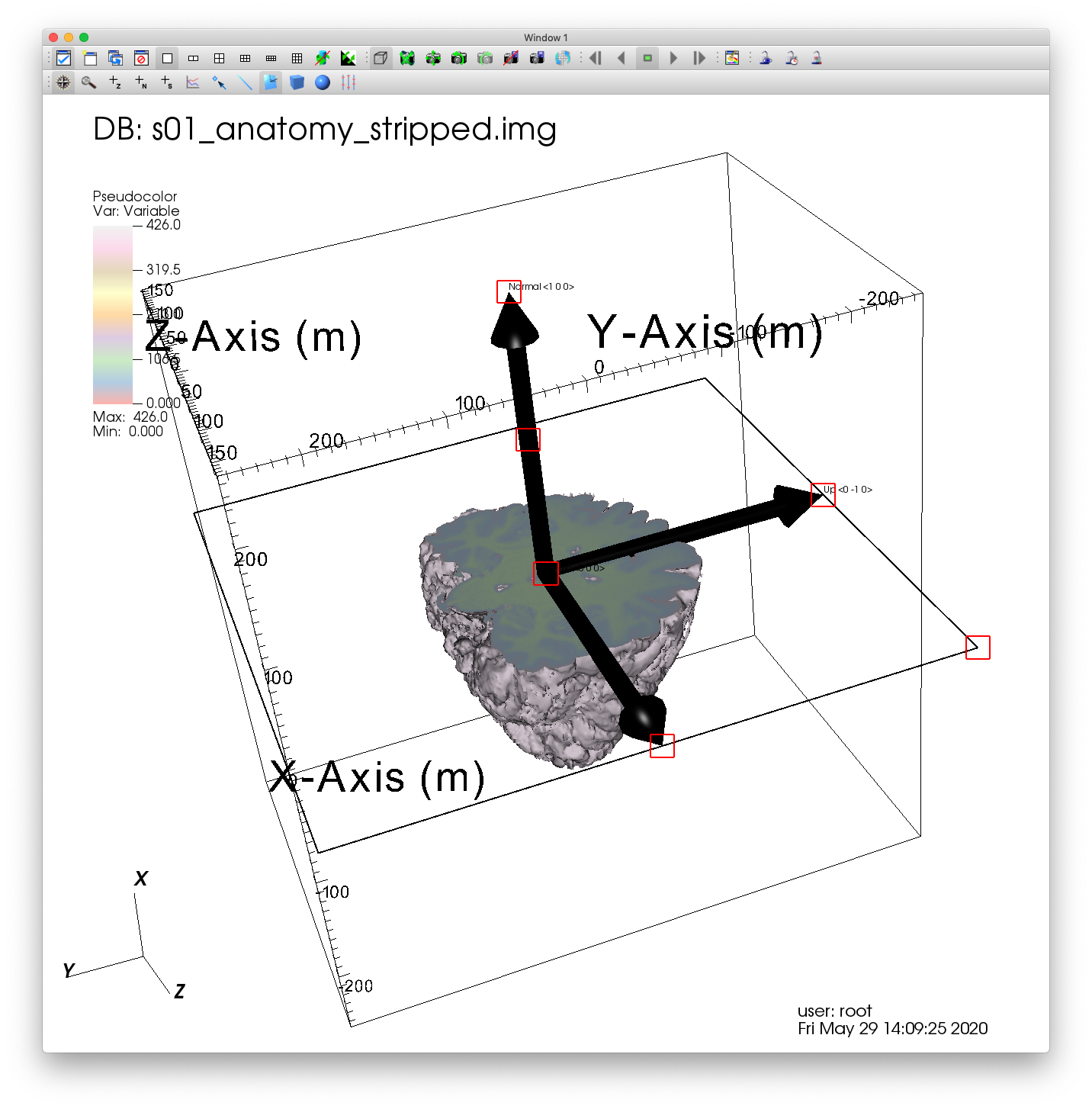 ../_images/MRI_3D_Axis.png