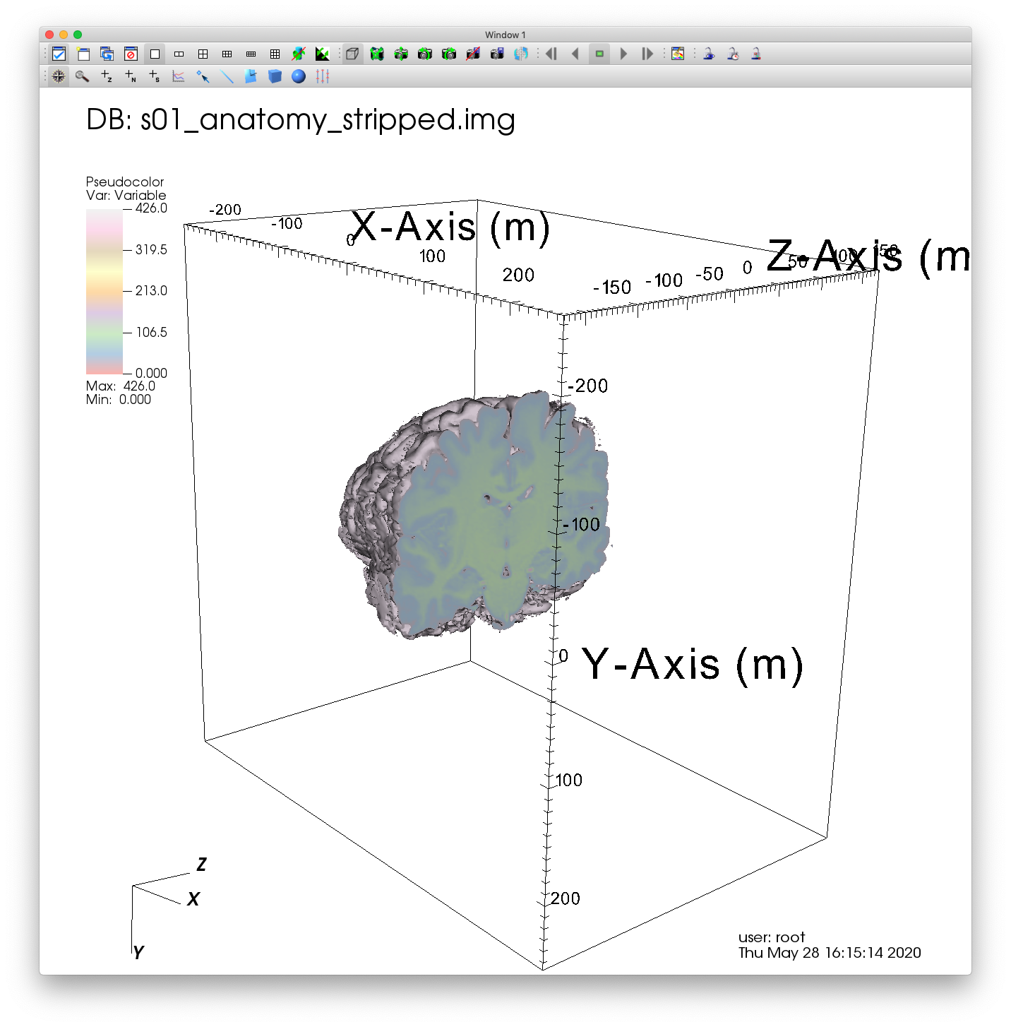 ../_images/MRI_Clip.png