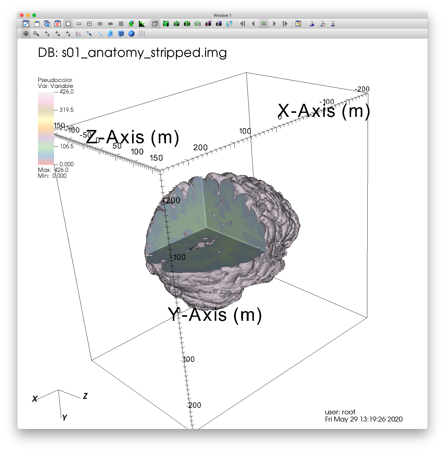 ../_images/MRI_Clip_3Plane.png