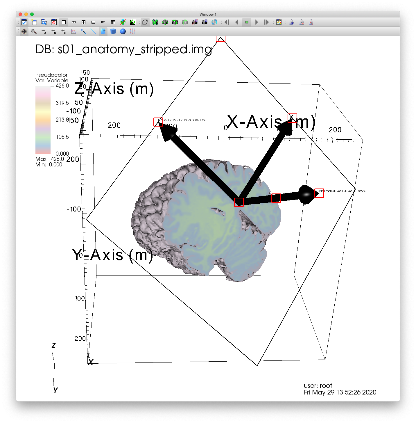 ../_images/MRI_Plane_Tool.png