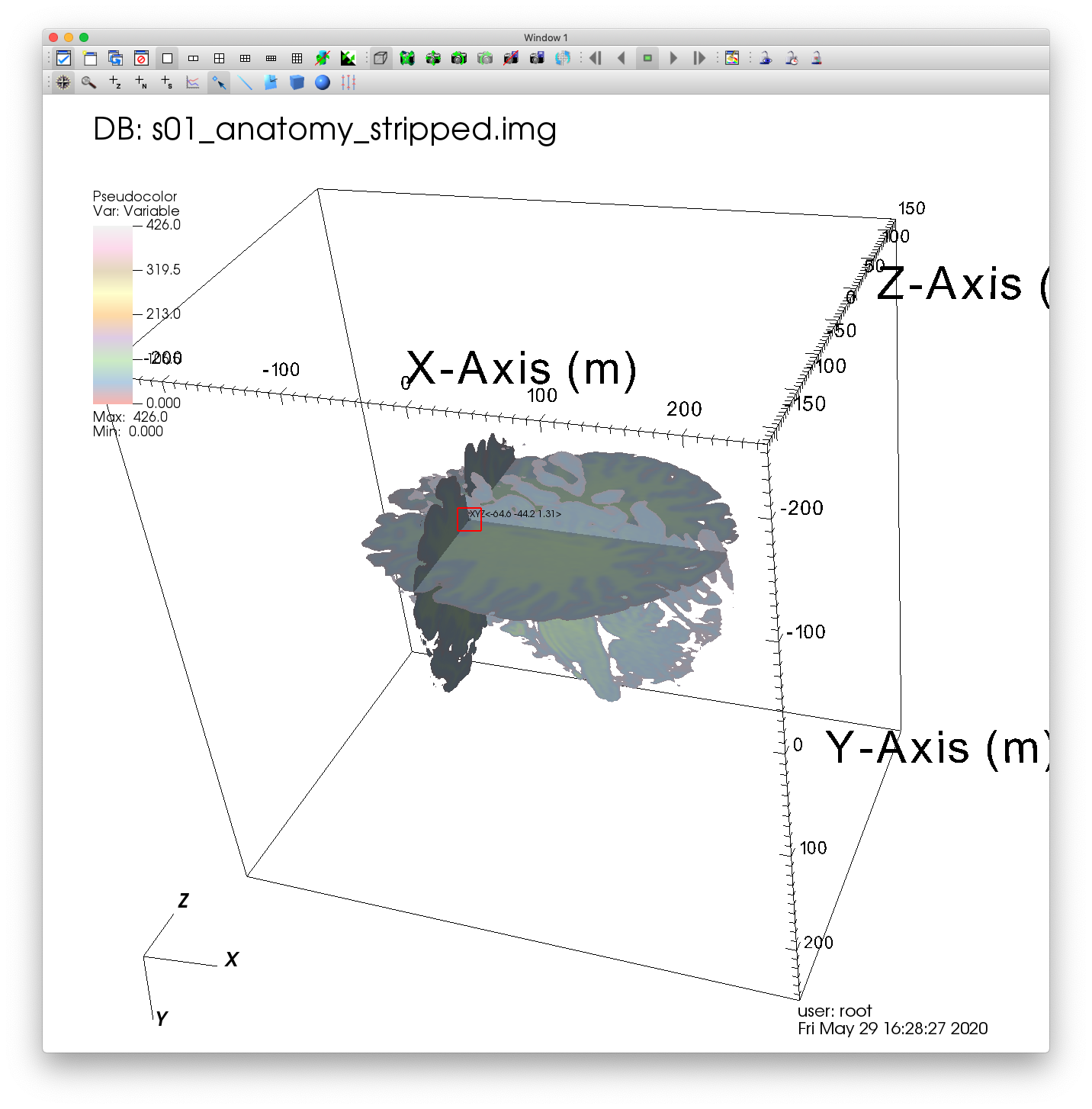 ../_images/MRI_Point_Tool_2.png