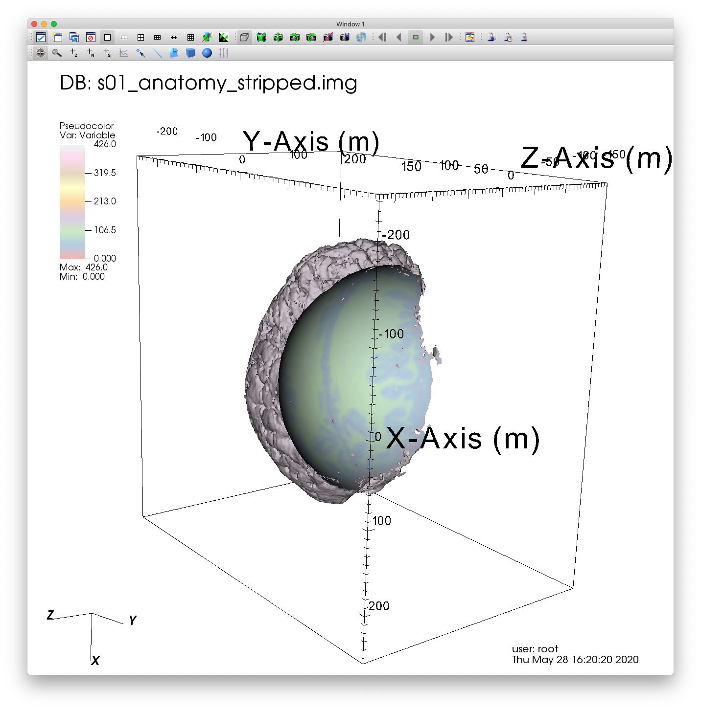 ../_images/MRI_Sphere_Clip.png