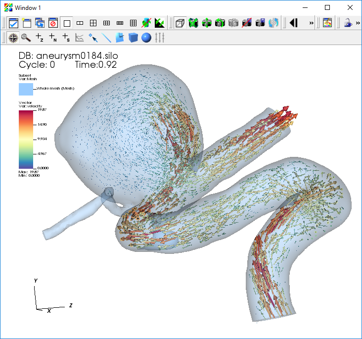 ../_images/Aneurysm-Vector.png