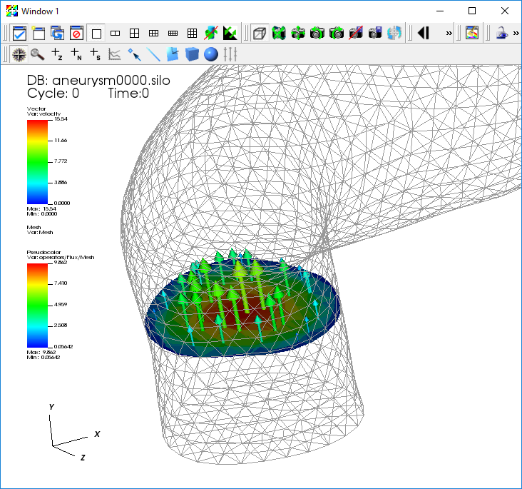 ../_images/Aneurysm-VectorFlux.png
