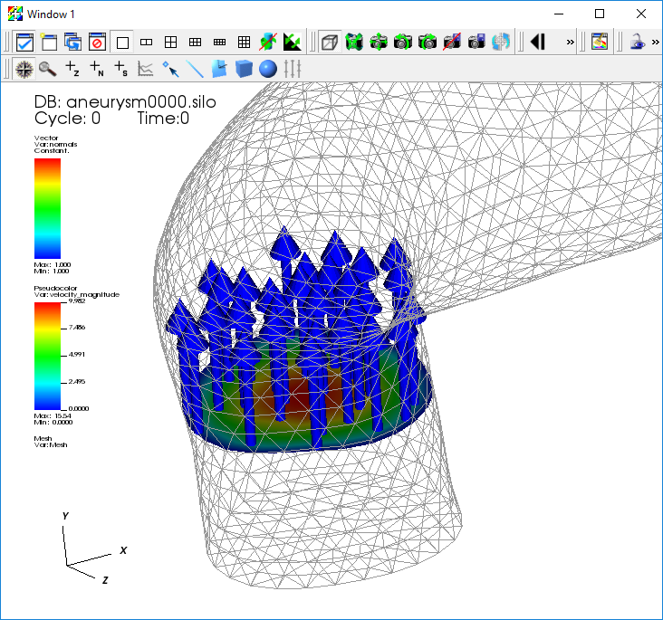 ../_images/Aneurysm-VectorNormals.png