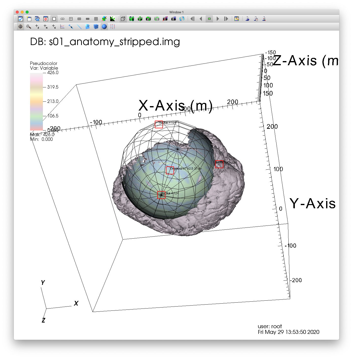 ../_images/MRI_Sphere_Tool.png